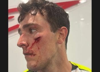 Vídeo: A aterradora queda de Cameron McAdoo que gerou bandeira vermelha e lesão