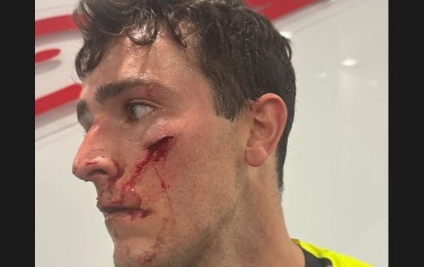 Vídeo: A aterradora queda de Cameron McAdoo que gerou bandeira vermelha e lesão