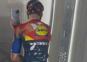Aleix Espargaró surpreende fãs com recuperação impressionante apenas 10 dias depois de fraturas graves nas vértebras!