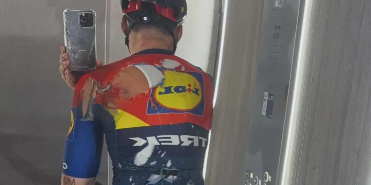 Aleix Espargaró surpreende fãs com recuperação impressionante apenas 10 dias depois de fraturas graves nas vértebras!