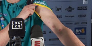 Pilotos feridos na corrida de MotoGP no Brasil com projeção de pedaços de asfalto