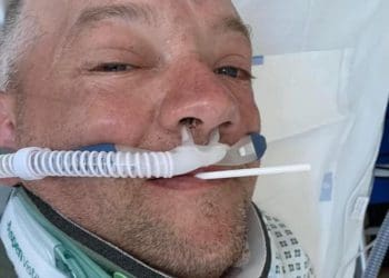 Anthony Redmond teve ‘sorte’ em estar vivo após assustador acidente e várias lesões no Ilha de Man TT